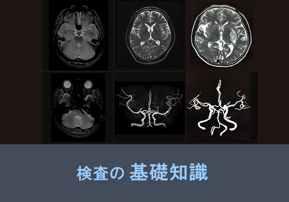 検査の基礎知識